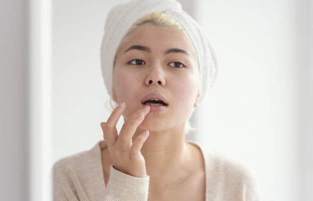 Tips Hilangkan Bibir Kering Secara Semula Jadi